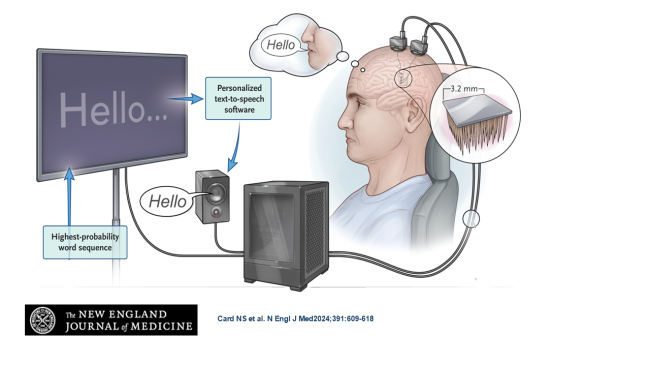 Schematic of the brain-to-computer device